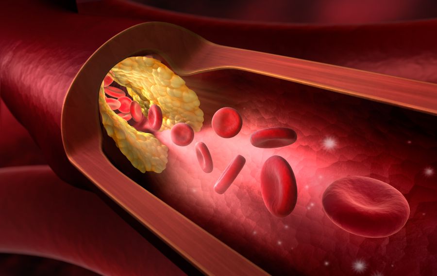 Peripherar Arterial Response